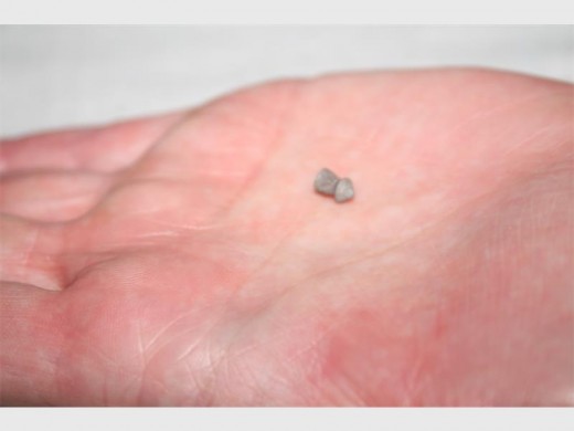 PROOF: The pellet which injured Sandy van Rooyen's beloved cat.