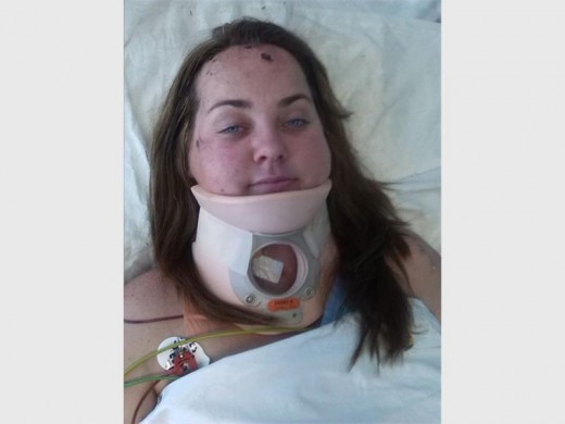 BROKEN NECK: Natalie Gunther had 40 percent of survival