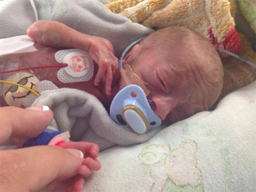 MIRACLE ; Hayley was born weighing around 600g. (Photo : A Test of Faith Facebook)